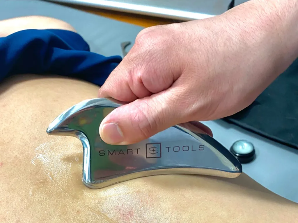 IASTM スマートツールを用いた施術の様子
