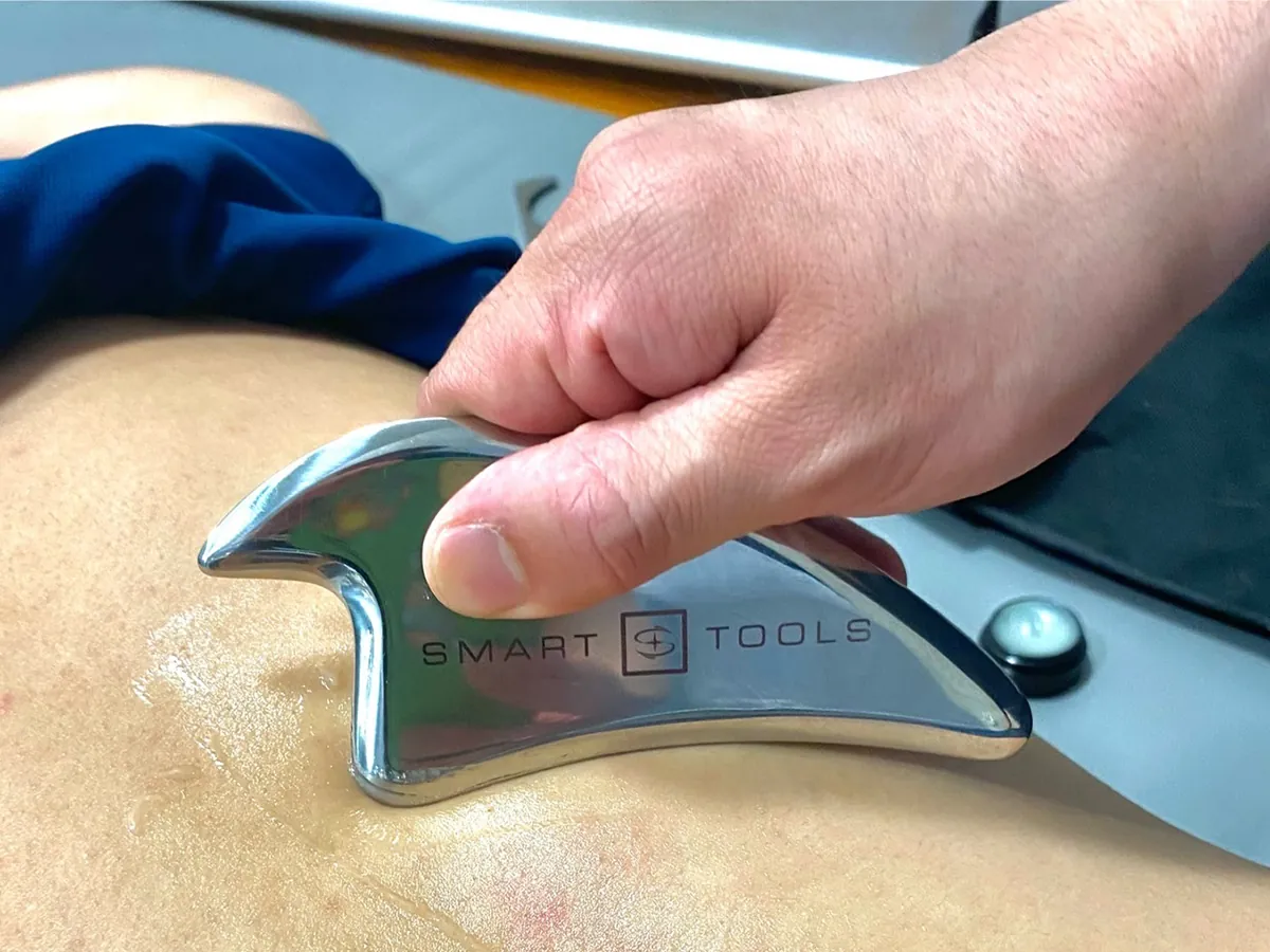IASTM スマートツールを用いた施術の様子
